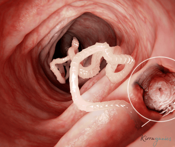 Understanding Parasites, Digestive Imbalance, and Why Gut Health Matters